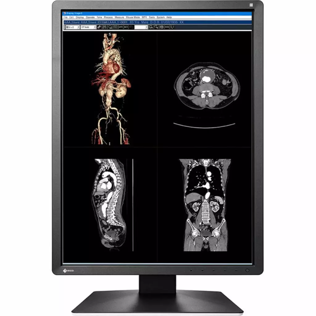 Монитор Eizo MX216-SB - 1