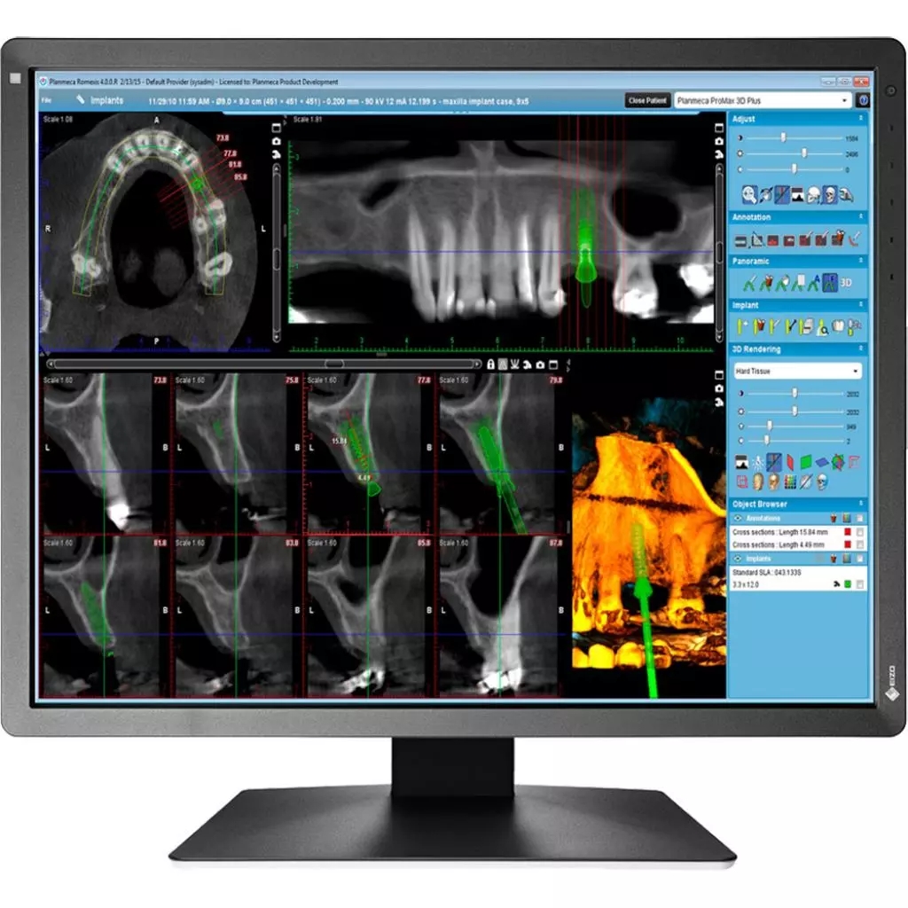 Монитор Eizo MX216-SB