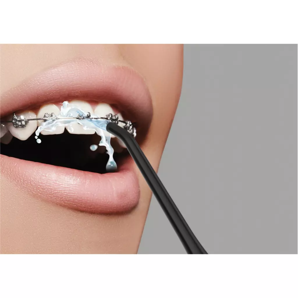 Ирригатор Evorei Boost 1 Gum Irrigator (5902479672489) - 7 Ирригатор Evorei Boost 1 Gum Irrigator (5902479672489) - 7