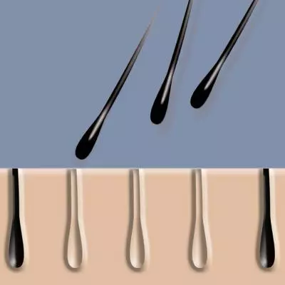 Эпилятор Remington Compact Control (IPL3500) - 2 Эпилятор Remington Compact Control (IPL3500) - 2